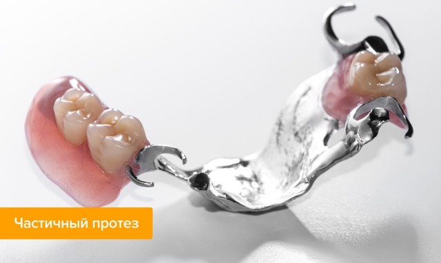 Техника изготовления съемных зубных протезов и применяемый материал